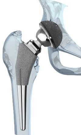 Medical and Prosthetic